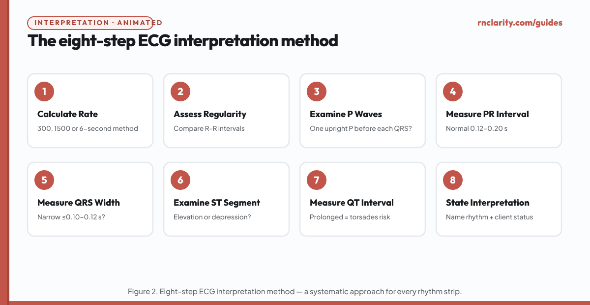 Animated flowchart of the eight-step ECG interpretation method: Step 1 Calculate Rate, Step 2 Assess Regularity, Step 3 Examine P Waves, Step 4 Measure PR Interval, Step 5 Measure QRS Width, Step 6 Examine ST Segment, Step 7 Measure QT Interval, Step 8 State Interpretation.