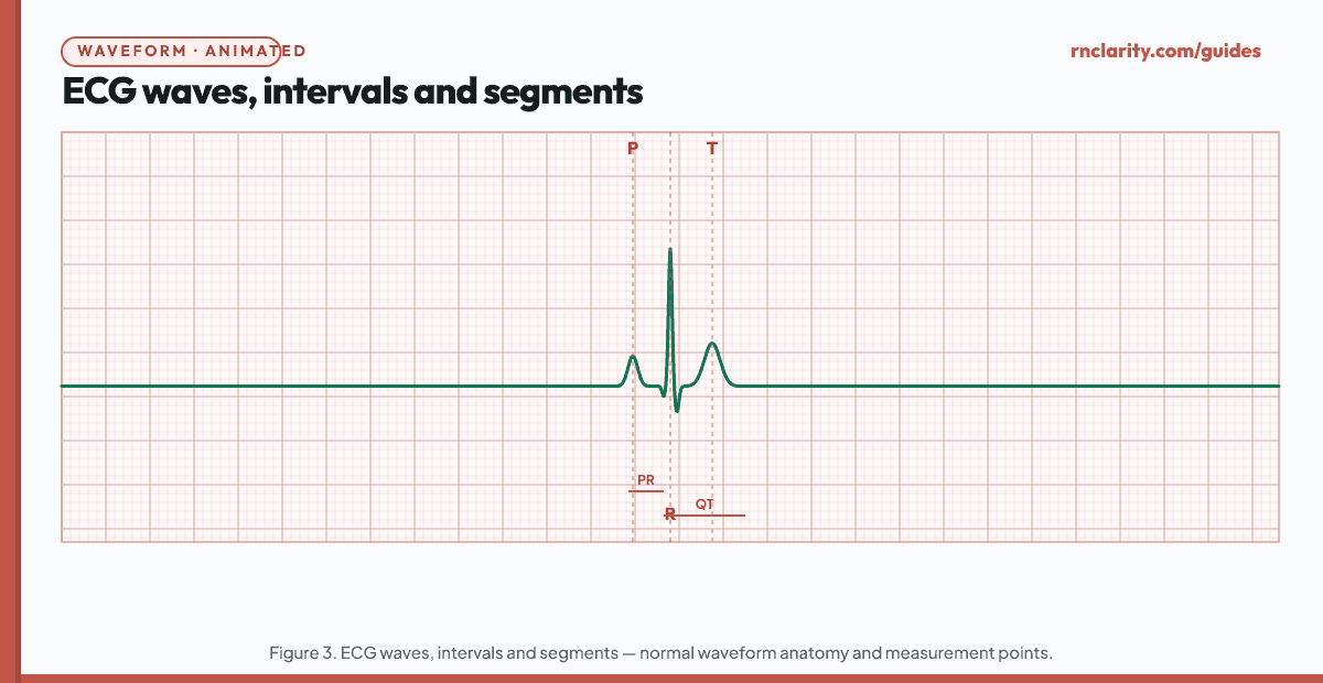 Animated ECG complex diagram labeling the P wave (atrial depolarization), PR segment, QRS complex (ventricular depolarization) with Q, R, and S waves identified, ST segment, T wave (ventricular repolarization), U wave, PR interval measured from onset of P to onset of QRS, QRS duration, QT interval from onset of QRS to end of T wave, and the isoelectric baseline.