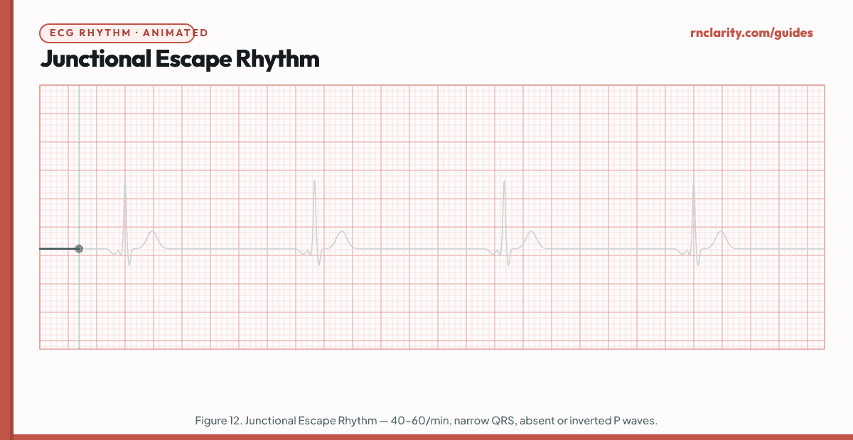 Animated ECG strip showing Junctional Escape Rhythm: regular slow rhythm at 40–60 per minute, absent or inverted P waves before or after each narrow QRS complex, rate slower than sinus, representing AV nodal escape pacemaker.