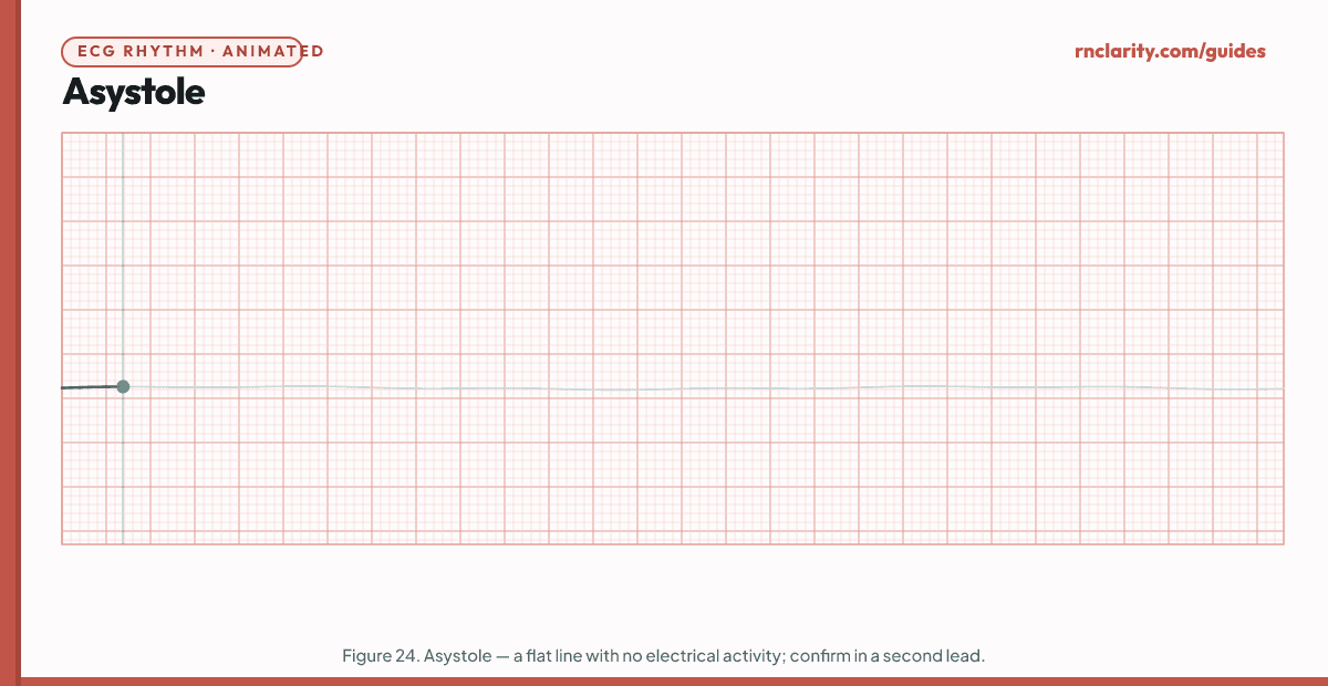 Animated ECG strip showing Asystole: completely flat isoelectric line with no cardiac electrical activity, no P waves, no QRS complexes, no waveforms of any kind.
