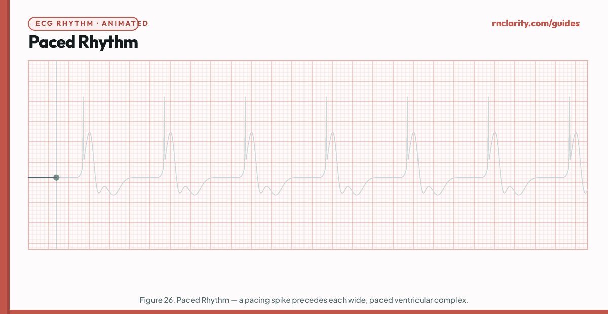 Animated ECG strip showing a Paced Rhythm: narrow vertical pacemaker spike (pacer artifact) immediately before each paced P wave and/or QRS complex, wide paced QRS complexes following ventricular pacing spikes, regular rhythm at the programmed pacemaker rate.